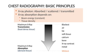 Comprehensive Radiological Diagnosis of Lung Diseases Using Chest X-Ray ...