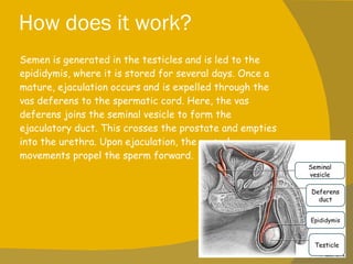 How does it work? Semen is generated in the testicles and is led to the epididymis, where it is stored for several days. Once a mature, ejaculation occurs and is expelled through the vas deferens to the spermatic cord. Here, the vas deferens joins the seminal vesicle to form the ejaculatory duct. This crosses the prostate and empties into the urethra. Upon ejaculation, the muscular movements propel the sperm forward. Seminal vesicle Deferens duct Epididymis Testicle 
