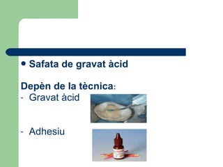 Safata de gravat àcid
Depèn de la tècnica:
- Gravat àcid
- Adhesiu
 
