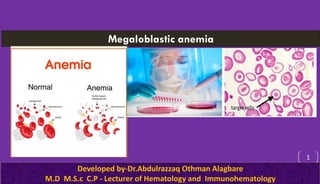 Megaloblastic anemia
Developed by-Dr.Abdulrazzaq Othman Alagbare
M.D M.S.c C.P - Lecturer of Hematology and Immunohematology
1
6/8/2020
 