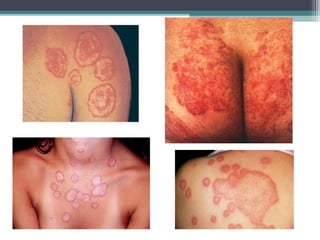 Departamento de
Agentes Biológicos
 