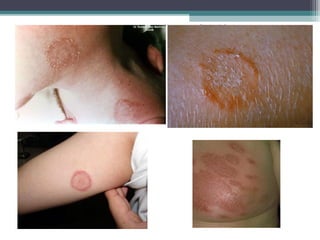 Departamento de
Agentes Biológicos
 