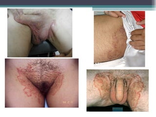 Departamento de
Agentes Biológicos
 