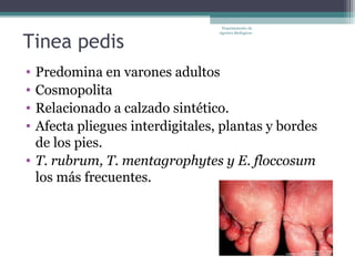 Departamento de



Tinea pedis
                                 Agentes Biológicos




• Predomina en varones adultos
• Cosmopolita
• Relacionado a calzado sintético.
• Afecta pliegues interdigitales, plantas y bordes
  de los pies.
• T. rubrum, T. mentagrophytes y E. floccosum
  los más frecuentes.
 