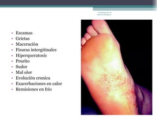 Departamento de
                              Agentes Biológicos




•   Escamas
•   Grietas
•   Maceración
•   Fisuras intergitinales
•   Hiperqueratosis
•   Prurito
•   Sudor
•   Mal olor
•   Evolución cronica
•   Exacerbaciones en calor
•   Remisiones en frio
 