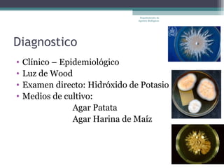 Departamento de
                                Agentes Biológicos




Diagnostico
•   Clínico – Epidemiológico
•   Luz de Wood
•   Examen directo: Hidróxido de Potasio
•   Medios de cultivo:
                 Agar Patata
                 Agar Harina de Maíz
 