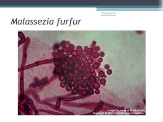 Departamento de
                    Agentes Biológicos



Malassezia furfur
 