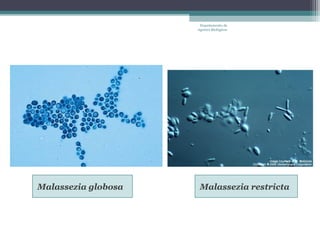 Departamento de
                     Agentes Biológicos




Malassezia globosa    Malassezia restricta
 