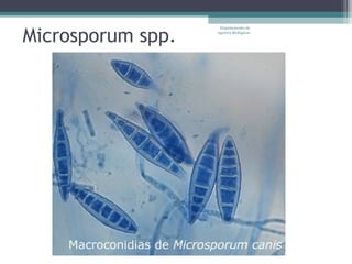 Microsporum spp.
                    Departamento de
                   Agentes Biológicos
 