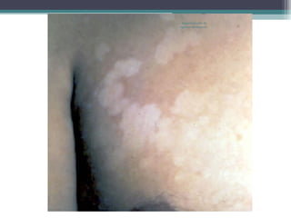 Departamento de
Agentes Biológicos
 