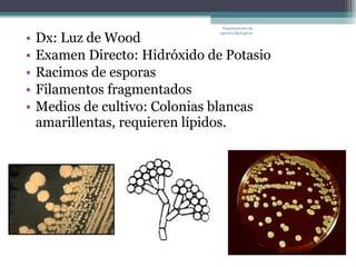 Departamento de


•   Dx: Luz de Wood
                                Agentes Biológicos




•   Examen Directo: Hidróxido de Potasio
•   Racimos de esporas
•   Filamentos fragmentados
•   Medios de cultivo: Colonias blancas
    amarillentas, requieren lípidos.
 