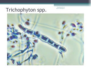 Departamento de


Trichophyton spp.
                    Agentes Biológicos
 