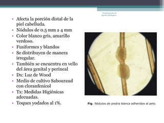 Departamento de
                                   Agentes Biológicos

• Afecta la porción distal de la
  piel cabelluda.
• Nódulos de 0.5 mm a 4 mm
• Color blanco gris, amarillo
  verdoso.
• Fusiformes y blandos
• Se distribuyen de manera
  irregular.
• También se encuentra en vello
  del área genital y perineal
• Dx: Luz de Wood
• Medio de cultivo Sabouraud
  con cloranfenicol
• Tx: Medidas Higiénicas
  adecuadas.
• Toques yodados al 1%.
 