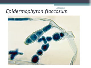 Departamento de
                   Agentes Biológicos



Epidermophyton floccosum
 
