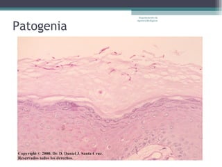 Departamento de



Patogenia
            Agentes Biológicos
 