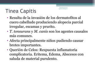 Departamento de



Tinea Capitis
                                Agentes Biológicos




• Resulta de la invasión de los dermatofitos al
  cuero cabelludo produciendo alopecia parcial
  irregular, escamas y prurito.
• T. tonsurans y M. canis son los agentes causales
  más comunes.
• Afecta principalmente niños pudiendo causar
  brotes importantes.
• Querión de Celos: Respuesta inflamatoria
  complicatoria. Eritema, Edema, Abscesos con
  saluda de material purulento.
 