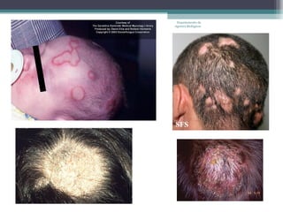 Departamento de
Agentes Biológicos
 