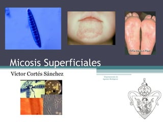 Micosis Superficiales
Víctor Cortés Sánchez    Departamento de
                        Agentes Biológicos
 