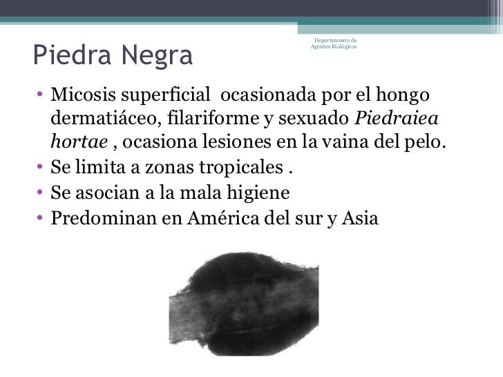 El medio del tratamiento de la madera del hongo
