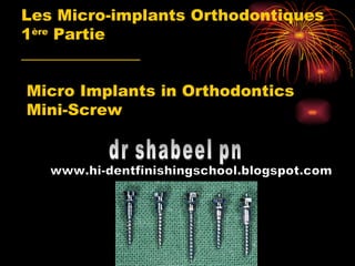 Les Micro-implants Orthodontiques 1 ère  Partie _______________  Micro Implants in Orthodontics  Mini-Screw  dr shabeel pn www.hi-dentfinishingschool.blogspot.com 