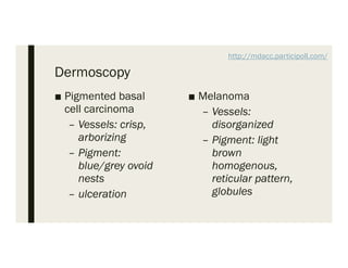Aborizing Pattern Melanoma Screening, Diagnosis, and Prevention – Kelly C. Nelson, MD | PDF
