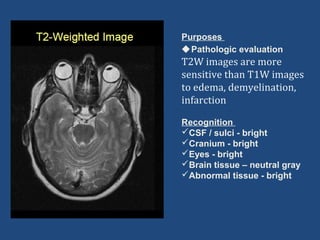 2 neuro. ixs 1 | PPT