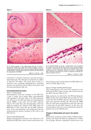 consisted of a network of astrocytic processes forming a
hypocellular gap. The third layer was formed of a ribbon
of astrocyte cell bodies. The fourth layer served as a
transition zone containing oligodendrocytes separating
between the third layer with its ribbon of astrocytes and
the brain parenchyma (Fig. 2b).
Immunohistochemical results
Group 1 (control group)
Immunopositive cells were numerous in the SGZ after
2 days, 2 weeks, and 4 weeks. Many immunopositive
cells appeared in the GCL (Figs 3–5). High expression
was observed in the SVZ and along the rostromigratory
stream (RMS) 2 days after the last BrdU injection
(Fig. 6). Two weeks later, the immunopositive cells were
observed reaching the olfactory bulb (OB) along the
RMS (Fig. 7). Four weeks after the last BrdU injection,
most of the immunopositive cells disappeared and the
immunoreactivity became localized to few cells in the
SVZ (Fig. 8).
Group 2 (soft diet-fed group)
Strong immunopositive reactions were observed in the
SGZ and the SVZ after 2 days, whereas weak reaction was
observed after 2 and 4 weeks both in the SGZ (Figs 9–11)
and in the SVZ (Figs 12–14).
Group 3 (omega 3-fortified diet-fed group)
The immunopositive cells were more numerous in the
SGZ and the GCL 2 days, 2 weeks, and 4 weeks after the
last BrdU injection (Figs 15–17).
High expression was observed in the SVZ and along the
RMS at 2 days after the last BrdU injection (Fig. 18). Two
weeks after the last BrdU injection, the immunopositive
cells were observed reaching the OB along the RMS
(Fig. 19). Still many immunopositive cells were observed
4 weeks after the last BrdU injection. At this time, the
immunopositive cells were seen incorporated among the
granular cells of the OB (Fig. 20).
Changes in BrdU-positive cell count in the dentate
gyrus
Quantitative assessment of the number of BrdU-immuo-
positive cells within the SGZ was significant (P  0.005)
for all groups. Post-hoc comparisons showed that at all
Figure 1.
(a) A photomicrograph of the hippocampal formation of group 1
showing the dentate gyrus (DG). (b) A photomicrograph of group 1
dentate gyrus showing its different layers: molecular (M) layer, granule
cell layer (GCL), and polymorphic layers (PL). Observe the hilus (H) and
the subgranular zone (SGZ).
HE, A =Â100, B = Â400.
Figure 2.
(a) A photomicrograph of group 1 subventricular zone throughout
the lateral wall of the lateral ventricle (LV). (b) A photomicrograph
of group 1 subventricular zone showing the different layers of the
subventricular zone: ependymal cells with microvilli (1), hypocellular
gap of astrocytic processes (2), a ribbon of astrocyte cell bodies (3),
and the transition zone (4).
HE, A = Â100, B = Â1000.
Omega 3 and neurogenesis Rifaai et al. 3
 
