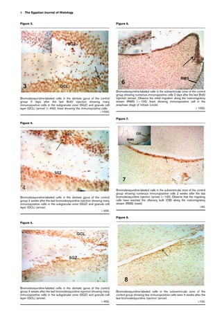Figure 6.
Bromodeoxyuridine-labeled cells in the subventricular zone of the control
group showing numerous immunopositive cells 2 days after the last BrdU
injection (arrow). Observe the initial migration along the rostromigratory
stream (RMS) ( Â 100). Inset showing immunopositive cell in the
anaphase stage of mitosis (circle).
Â 1000.
Figure 8.
Bromodeoxyuridine-labeled cells in the subventricular zone of the
control group showing few immunopositive cells seen 4 weeks after the
last bromodeoxyuridine injection (arrow)
Â100.
Figure 4.
Bromodeoxyuridine-labeled cells in the dentate gyrus of the control
group 2 weeks after the last bromodeoxyuridine injection showing many
immunopositive cells in the subgranular zone (SGZ) and granule cell
layer (GCL) (arrow).
Â 400.
Figure 5.
Bromodeoxyuridine-labeled cells in the dentate gyrus of the control
group 4 weeks after the last bromodeoxyuridine injection showing many
immunopositive cells in the subgranular zone (SGZ) and granule cell
layer (GCL) (arrow).
Â 400.
Figure 7.
Bromodeoxyuridine-labeled cells in the subventricular zone of the control
group showing numerous immunopositive cells 2 weeks after the last
bromodeoxyuridine injection (arrow) (Â 100). Observe that the migrating
cells have reached the olfactory bulb (OB) along the rostromigratory
stream (RMS) (inset).
Â40.
Figure 3.
Bromodeoxyuridine-labeled cells in the dentate gyrus of the control
group 2 days after the last BrdU injection showing many
immunopositive cells in the subgranular zone (SGZ) and granule cell
layer (GCL) (arrow) (Â 400). Inset showing the immunopositive cells
Â1000.
4 The Egyptian Journal of Histology
 