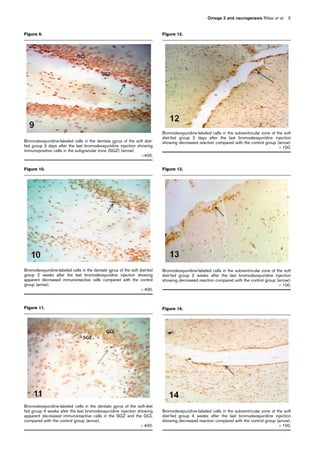 Figure 9.
Bromodeoxyuridine-labeled cells in the dentate gyrus of the soft diet-
fed group 2 days after the last bromodeoxyuridine injection showing
immunopositive cells in the subgranular zone (SGZ) (arrow)
Â400.
Figure 10.
Bromodeoxyuridine-labeled cells in the dentate gyrus of the soft diet-fed
group 2 weeks after the last bromodeoxyuridine injection showing
apparent decreased immunoreactive cells compared with the control
group (arrow).
Â 400.
Figure 11.
Bromodeoxyuridine-labeled cells in the dentate gyrus of the soft-diet
fed group 4 weeks after the last bromodeoxyuridine injection showing
apparent decreased immunoreactive cells in the SGZ and the GCL
compared with the control group (arrow).
Â 400.
Figure 12.
Bromodeoxyuridine-labeled cells in the subventricular zone of the soft
diet-fed group 2 days after the last bromodeoxyuridine injection
showing decreased reaction compared with the control group (arrow)
Â 100.
Figure 13.
Bromodeoxyuridine-labeled cells in the subventricular zone of the soft
diet-fed group 2 weeks after the last bromodeoxyuridine injection
showing decreased reaction compared with the control group (arrow).
Â 100.
Figure 14.
Bromodeoxyuridine-labeled cells in the subventricular zone of the soft
diet-fed group 4 weeks after the last bromodeoxyuridine injection
showing decreased reaction compared with the control group (arrow).
Â 100.
Omega 3 and neurogenesis Rifaai et al. 5
 
