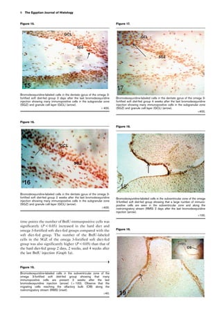 time points the number of BrdU-immuopositive cells was
significantly (P  0.05) increased in the hard diet and
omega 3-fortified soft diet-fed groups compared with the
soft diet-fed group. The number of the BrdU-labeled
cells in the SGZ of the omega 3-fortified soft diet-fed
group was also significantly higher (P0.05) than that of
the hard diet-fed group 2 days, 2 weeks, and 4 weeks after
the last BrdU injection (Graph 1a).
Figure 16.
Bromodeoxyuridine-labeled cells in the dentate gyrus of the omega 3-
fortified soft diet-fed group 2 weeks after the last bromodeoxyuridine
injection showing many immunopositive cells in the subgranular zone
(SGZ) and granule cell layer (GCL) (arrow).
Â400.
Figure 15.
Bromodeoxyuridine-labeled cells in the dentate gyrus of the omega 3-
fortified soft diet-fed group 2 days after the last bromodeoxyuridine
injection showing many immunopositive cells in the subgranular zone
(SGZ) and granule cell layer (GCL) (arrow).
Â 400.
Figure 17.
Bromodeoxyuridine-labeled cells in the dentate gyrus of the omega 3-
fortified soft diet-fed group 4 weeks after the last bromodeoxyuridine
injection showing many immunopositive cells in the subgranular zone
(SGZ) and granule cell layer (GCL) (arrow).
Â400.
Figure 18.
Bromodeoxyuridine-labeled cells in the subventricular zone of the omega
3-fortified soft diet-fed group showing that a large number of immuno-
positive cells are seen in the subventricular zone and along the
rostromigratory stream (RMS) 2 days after the last bromodeoxyuridine
injection (arrow).
Â100.
Figure 19.
Figure 19.
Bromodeoxyuridine-labeled cells in the subventricular zone of the
omega 3-fortified soft diet-fed group showing that many
immunopositive cells are present 2 weeks after the last
bromodeoxyuridine injection (arrow) ( Â 100). Observe that the
migrating cells reaching the olfactory bulb (OB) along the
rostromigratory stream (RMS) (inset).
Â40.
6 The Egyptian Journal of Histology
 