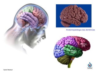 Anatomopatologia das demências Hybrid Medical 