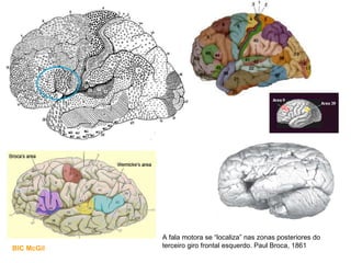 A fala motora se “localiza” nas zonas posteriores do terceiro giro frontal esquerdo. Paul Broca, 1861 BIC McGil 