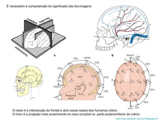 O násio é a intersecção do frontal e dois ossos nasais dos humanos crânio. O ínion é a projeção mais proeminente do osso occipital na  parte posterioinferior do crânio  http://www.alivelearn.net/?cat=6&paged=4   É necessário a compreensão do significado das bio-imagens 