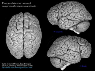 É necessário uma razoável  compreensão da neuroanatomia  Digital Anatomist Project, Dept. Biological Structure, University of Washington, Seattle. http://www9.biostr.washington.edu/da.html H. Esquerdo H. Direito 