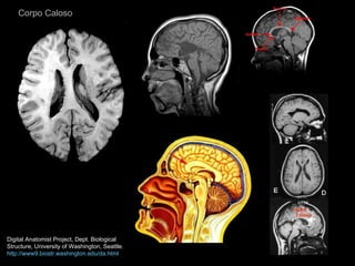 Corpo Caloso Digital Anatomist Project, Dept. Biological Structure, University of Washington, Seattle. http://www9.biostr.washington.edu/da.html 