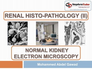RENAL HISTO-PATHOLOGY (II)
             m




     NORMAL KIDNEY
  ELECTRON MICROSCOPY
          Mohammed Abdel Gawad
 