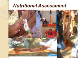 Nutritional Assessment
101
2/7/2011 S.E.
 