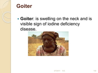 Goiter
 Goiter: is swelling on the neck and is
visible sign of iodine deficiency
disease.
2/7/2011 S.E. 130
 