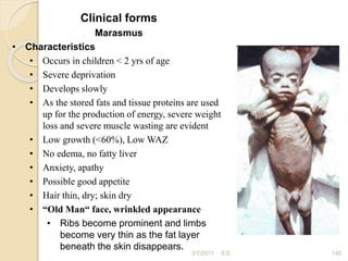 Clinical forms
Marasmus
• Characteristics
• Occurs in children < 2 yrs of age
• Severe deprivation
• Develops slowly
• As the stored fats and tissue proteins are used
up for the production of energy, severe weight
loss and severe muscle wasting are evident
• Low growth (<60%), Low WAZ
• No edema, no fatty liver
• Anxiety, apathy
• Possible good appetite
• Hair thin, dry; skin dry
• “Old Man“ face, wrinkled appearance
• Ribs become prominent and limbs
become very thin as the fat layer
beneath the skin disappears.
2/7/2011 145
S.E.
 