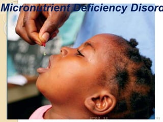 Micronutrient Deficiency Disord
2/7/2011 S.E. 163
 