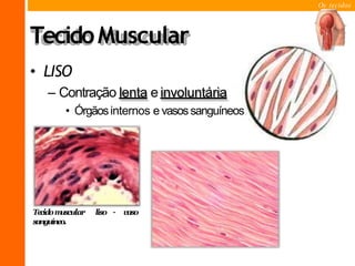 Os tecidos
TecidoMuscular
• LISO
– Contração lenta einvoluntária
• Órgãosinternos e vasossanguíneos
liso – vaso
Tecidom
uscular
sanguíneo.
 