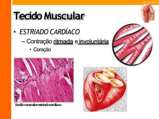 Os tecidos
TecidoMuscular
• ESTRIADO CARDÍACO
– Contração ritmada einvoluntária
• Coração
Tecidomuscularestriadocardíaco.
 