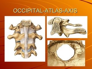 OCCIPITAL-ATLAS-AXIS  