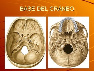 BASE DEL CRÁNEO 