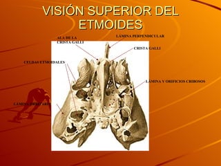 VISIÓN SUPERIOR DEL ETMOIDES LÁMINA PERPENDICULAR ALA DE LA CRISTA GALLI CRISTA GALLI LÁMINA Y ORIFICIOS CRIBOSOS CELDAS ETMOIDALES LÁMINA ORBITARIA 