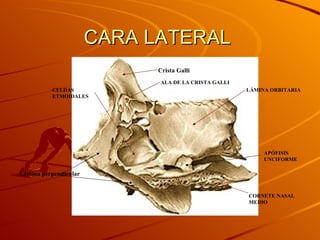 CARA LATERAL  Crista Galli ALA DE LA CRISTA GALLI APÓFISIS UNCIFORME LÁMINA ORBITARIA Lámina perpendicular CORNETE NASAL MEDIO CELDAS ETMOIDALES 