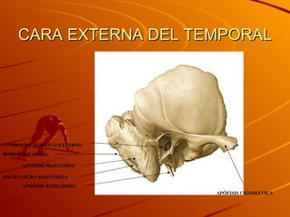 CARA EXTERNA DEL TEMPORAL APÓFISIS MASTOIDES APÓFISIS ESTILOIDES APÓFISIS CIGOMÁTICA CONDUCTO AUDITIVO EXTERNO ESCOTADURA MASTOIDEA BORDE OCCIPITAL 