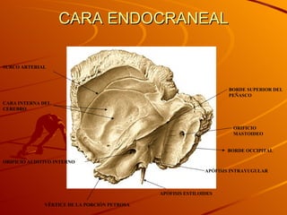 CARA ENDOCRANEAL BORDE OCCIPITAL ORIFICIO MASTOIDEO ORIFICIO AUDITIVO INTERNO BORDE SUPERIOR DEL PEÑASCO CARA INTERNA DEL CEREBRO SURCO ARTERIAL VÉRTICE DE LA PORCIÓN PETROSA APÓFISIS ESTILOIDES APÓFISIS INTRAYUGULAR 