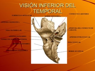 VISIÓN INFERIOR DEL TEMPORAL APÓFISIS INTRAYUGULAR FOSA YUGULAR CONDUCTO CAROTIDEO APÓFISIS ESTILOIDES APÓFISIS CIGOMÁTICA TUBÉRCULO ARTICULAR FOSA MANDIBULAR BORDE ESFENOIDAL APÓFISIS MASTOIDEA ESCOTADURA MASTOIDEA BORDE OCCIPITAL CONDUCTO AUDITIVO EXTERNO APERTURA DEL CONDUCTO DE CARACOL 