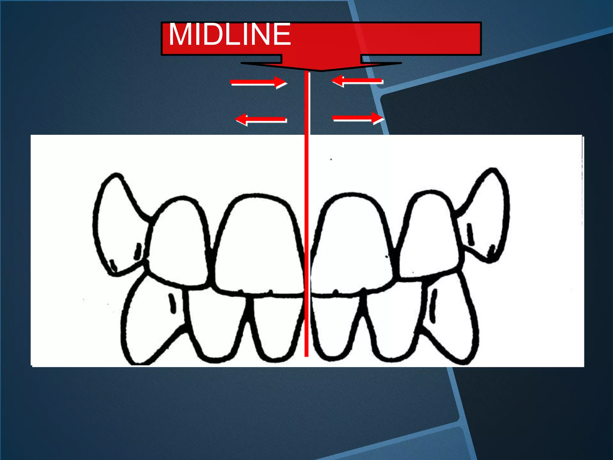 MIDLINE
 